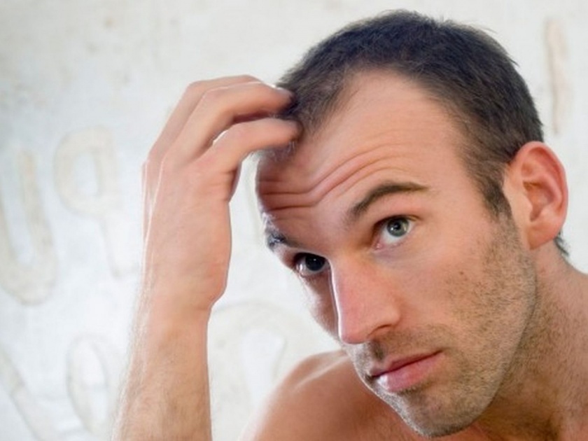 Diabetes can be a reason of hair loss in men, here's the reason | पुरूषांमध्ये केसगळतीच्या वेगवेगळ्या कारणांपैकी एक मुख्य कारण, तुम्हाला माहीत आहे का?