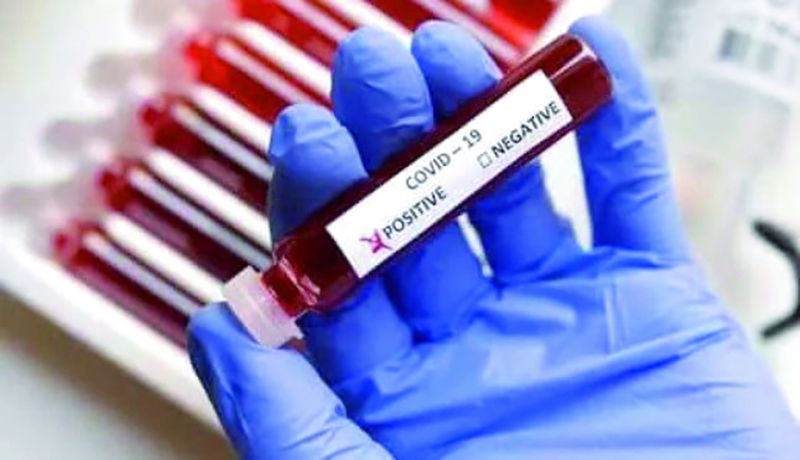 CoronaVirus in Nagpur: Coronavirus decline again | CoronaVirus in Nagpur : कोरोनाबाधितांमध्ये पुन्हा घट, १५९ रुग्ण, ८ मृत्यूची नोंद