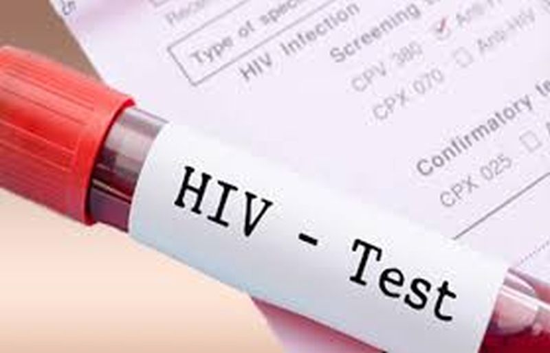 Corona causes zero HIV testing! | कोरोनामुळे ‘एचआयव्ही’ तपासणी शून्य!