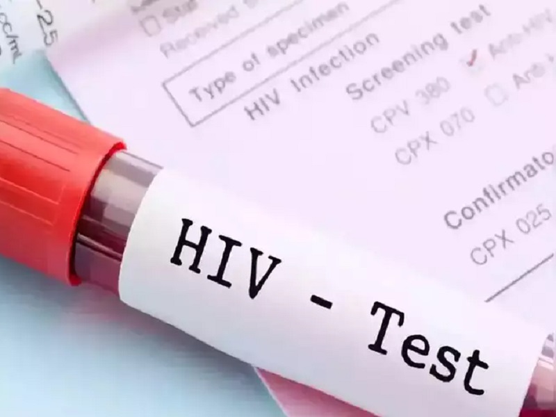 more than 85 thousand people infected with hiv due to unprotected sex in lockdown | बापरे! लॉकडाऊनमध्ये देशात 85 हजारांहून अधिक लोकांना HIVची लागण; महाराष्ट्रात सर्वाधिक रुग्ण