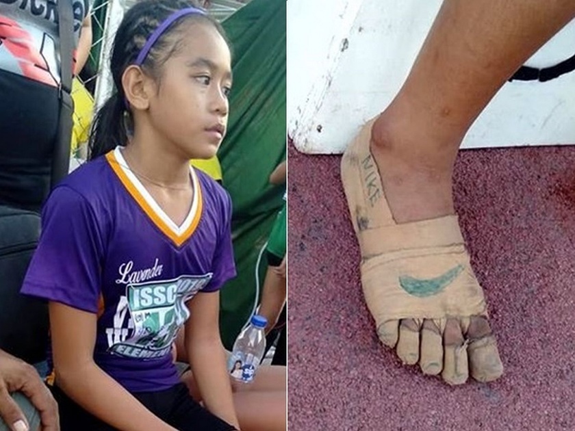 The Internet Is Blown Away By This 11-Year-Old Athlete Who Won Gold Medals In Shoes Made of Bandages | जिंकलंस पोरी! 'या' खेळाडूचे शूज पाहून भावूक झाले लोक, खरे शूज नसूनही जिंकली तीन गोल्ड मेडल!