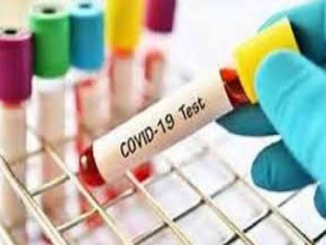 coronavirus: The corona virus will now be diagnosed in just 5 seconds, IIT ruraki professor claimed BKP | आयआयटीमधील प्राध्यापकाची कमाल; आता अवघ्या 5 सेकंदात कोरोनाचे निदान होणार