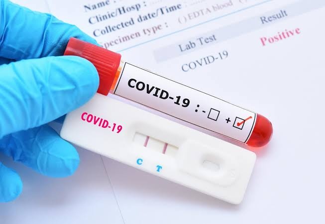 Corona virus: 1104 new corona infections in Pimpri on Wednesday; ! 1 thousand 071 people released from coronation | Corona virus : पिंपरीत बुधवारी ११०४ नवीन कोरोनाबाधित; १०७१ जण कोरोनामुुुक्त