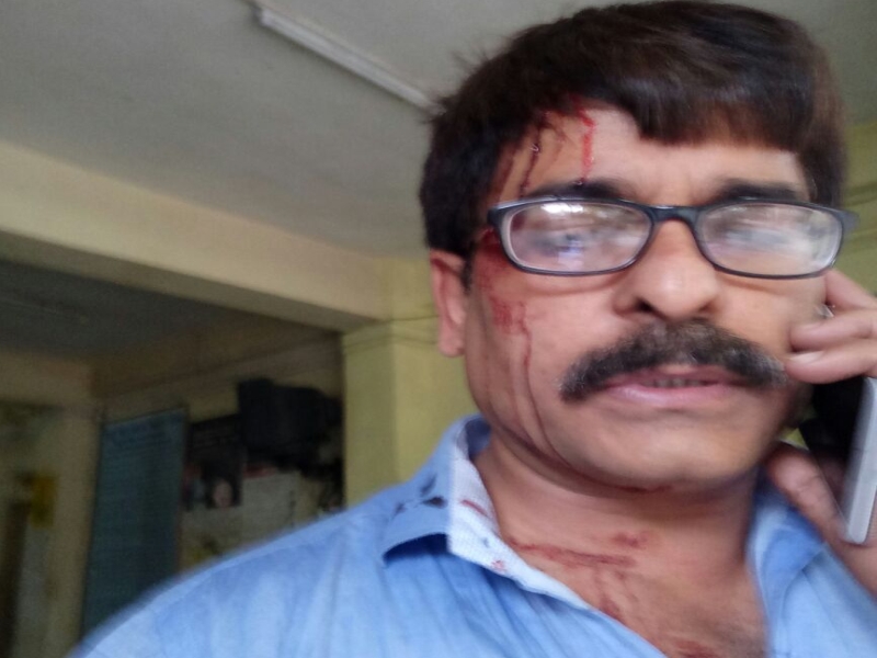 India Tv journalist Sudhir Shukla beaten in local train by group | लोकलमध्ये टोळक्याची दादागिरी; ज्येष्ठ पत्रकारावर जीवघेणा हल्ला