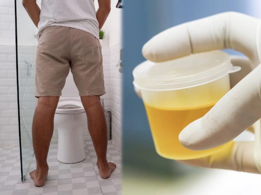 Diabetes symptoms: Can cloudy urine be a sign of diabetes | Diabetes symptoms : लगेचच तपासून घ्या 'ब्लड शुगर लेव्हल', जर लघवीच्या रंगात झाला असेल 'असा' बदल