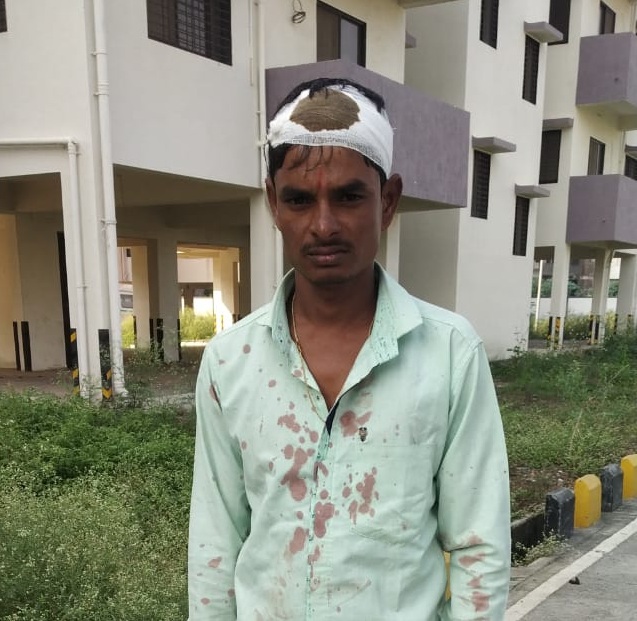 Pregnant woman's husband beaten and robbed at Jalana Women Hospital | गर्भवती महिलेच्या पतीस महिला रुग्णालयात मारहाण करून लुटले