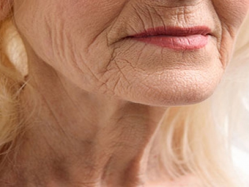 Special solution for remove wrinkles on the neck | कमी वयातच आलेल्या मानेवरच्या सुरकुत्या टाळण्यासाठी एक्सपर्टस सांगतात खास उपाय...