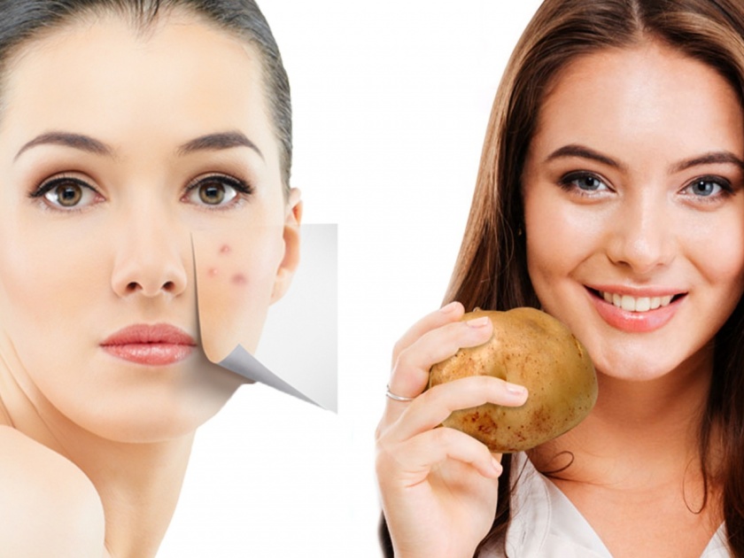 Benefits of potato for healthy and glowing skin | त्वचेवरील सुरकुत्या आणि डाग दूर करण्यासाठी 'असा' वापरा बटाटा, मग बघा कमाल!