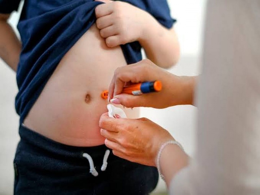What is juvenile diabetes? Know the causes and symptoms | लहान मुलांनाच होतो जुवेनाइल डायबिटीस, जाणून घ्या कारणे आणि लक्षणे....