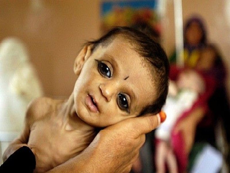 Over 9,000 infants lost their lives in eight months across the state | राज्यभरात आठ महिन्यांत ९ हजारांहून अधिक नवजात बालकांनी गमावला जीव