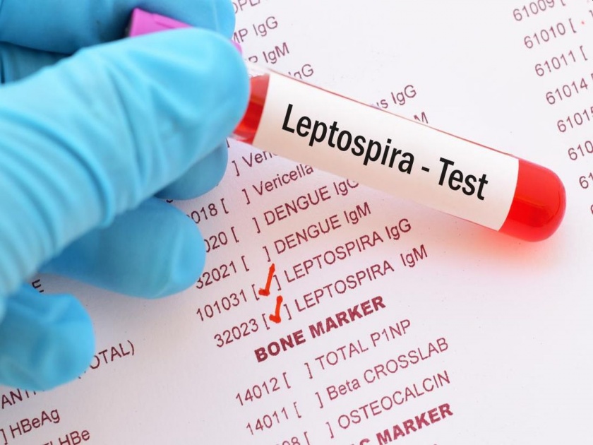10 people die of leptospirosis in Sapgaon | सापगावातील १० जणांचा लेप्टोस्पायरोसीसने मृत्यू