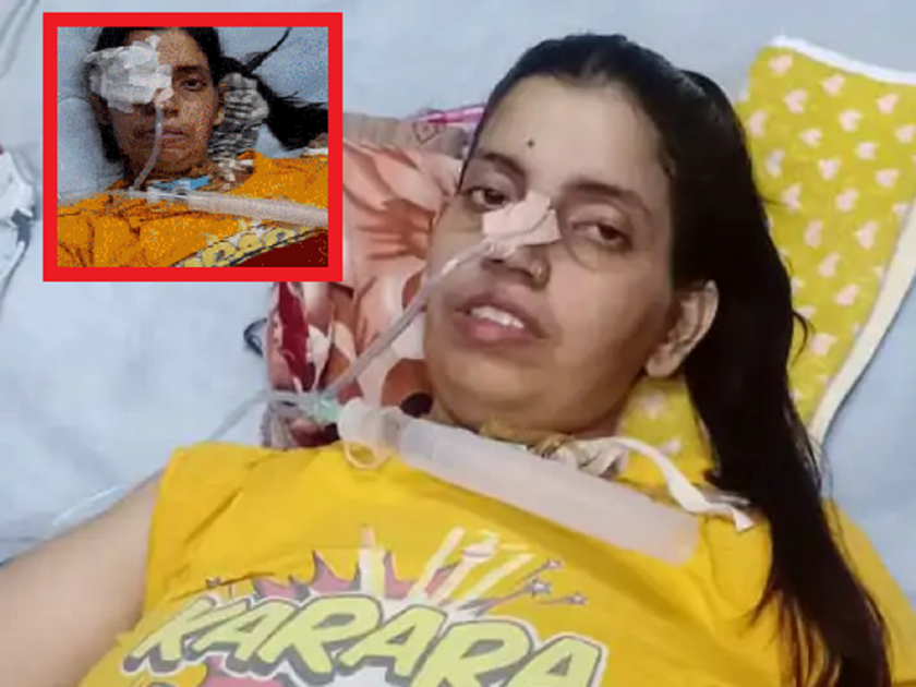 Rajasthan kota govt hospital; Rat bit eye of paralysis woman patient in Government Hospital | धक्कादायक घटना! सरकारी रुग्णालयात महिला रुग्णाच्या डोळ्यांचा उंदराने घेतला चावा