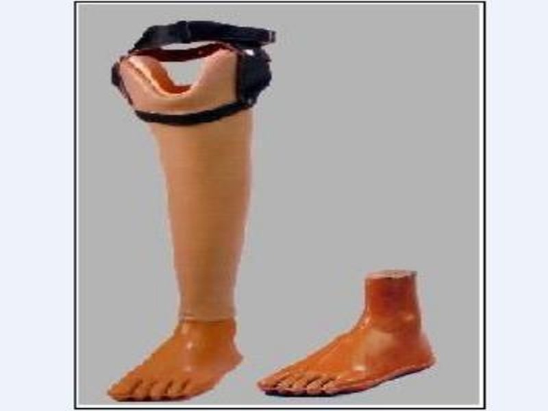  Artificial legs fitted to the prisoners | कैद्यांना बसविले कृत्रिम पाय
