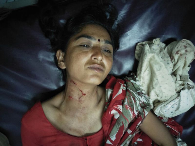 the leopard attacked on woman in Chalisgaon taluka | चाळीसगाव तालुक्यातील उपखेड येथे बिबट्याचा महिलेवर हल्ला