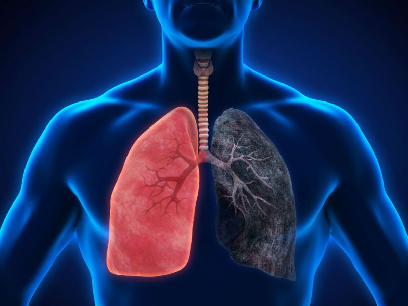 India fourth rank in lung cancer do not ignore these symptoms | फुफ्फुसांच्या कॅन्सरमध्ये भारत चौथ्या क्रमांकावर; जाणून घ्या लक्षणं