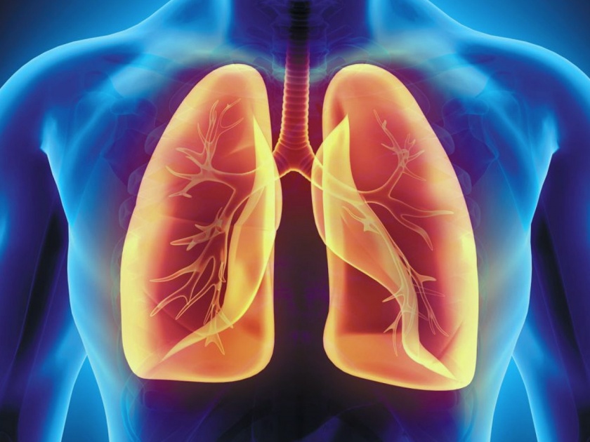 lung cancer causes early symptoms diagnosis and treatment explained by doctor | फक्त धुम्रपान नाही तर 'या' कारणांमुळे उद्भवतोय फुफ्फुसांच्या कॅन्सरचा धोका; जाणून घ्या लक्षणं