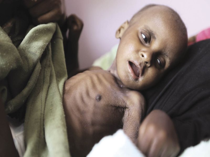  166 malnourished children in Erandol taluka | एरंडोल तालुक्यात १६६ कुपोषित बालके