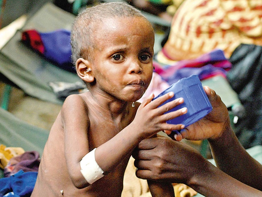 Aurangabad district has 4,733 children malnourished | औरंगाबाद जिल्ह्यात ४ हजार ७३३ बालके कुपोषित