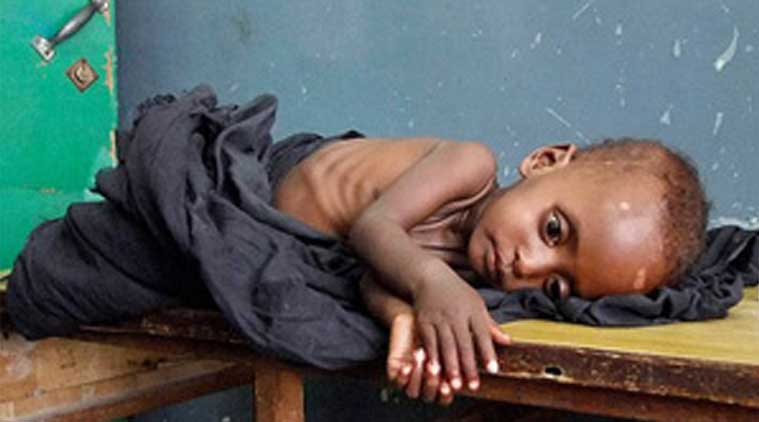 when end Melghat's childhood fatality, malnutrition? | मेळघाटाच्या ललाटीचा बालमृत्यू, कुपोषणाचा डाग केव्हा हटेल?