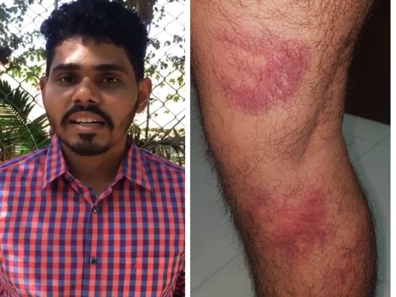 Police beating boy because of asking question at Pune | फक्त प्रश्न विचारला म्हणून तरुणाला पोलिसांनी अमानुष मारहाण