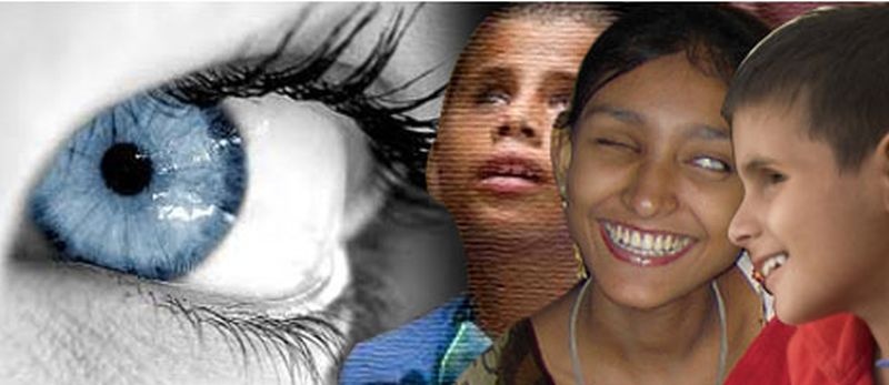 World Eye Donation Day; Eclipse of the corona for cataract surgery | जागतिक नेत्रदान दिवस; मोतीबिंदू शस्त्रक्रियेला कोरोनाचे ग्रहण