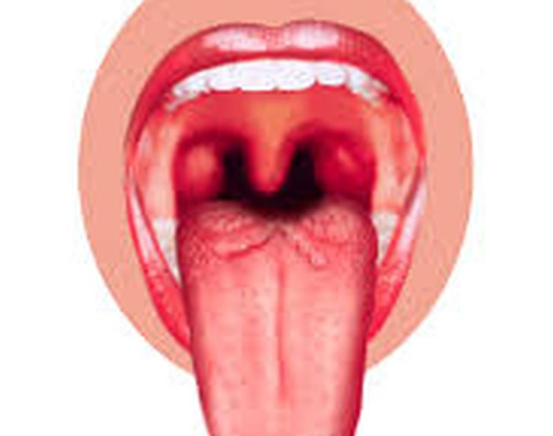 Over 36000 people have mouth cancer! | तिशीतील ३६ हजारांपेक्षा जास्त लोकांना मुख कर्करोग!