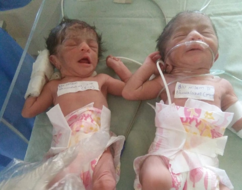 CoronaVirus News in Ahmednagar: Corona positive woman gives birth to twins rkp | CoronaVirus News in Ahmednagar : कोरोना पॉझिटिव्ह महिलेने दिला जुळ्या बाळांना जन्म