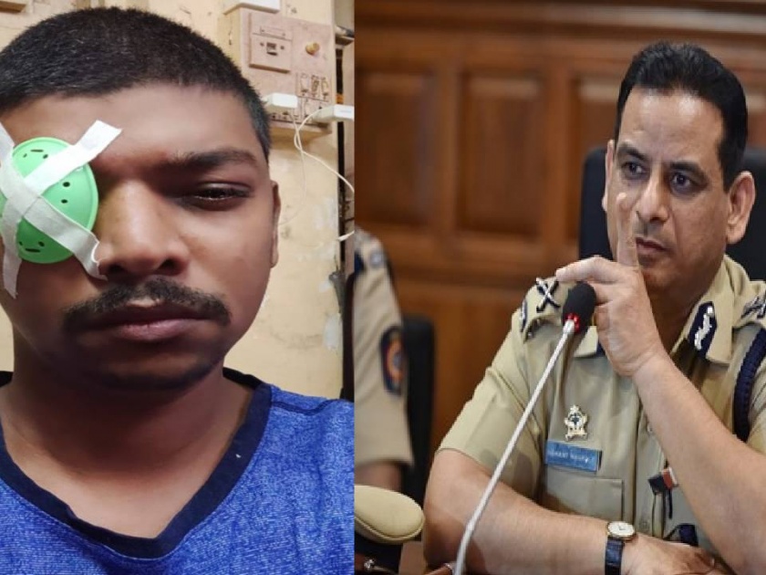 Lokmat Impact: Suspension of police for hitting youth with iron objects, immediate action by Mumbai CP Hemant Nagarale | लोकमत इम्पॅक्ट: तरुणाच्या डोळ्यावर लोखंडी वस्तू मारणाऱ्या पोलिसाचं निलंबन, हेमंत नगराळेंची तातडीनं कारवाई