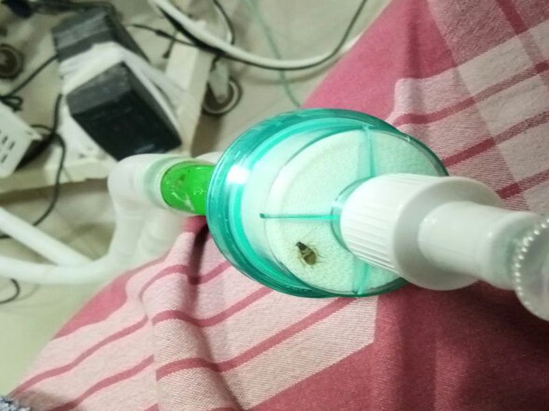 cockroach found in ventilator in nashiks hospital | नाशिकच्या मविप्र वैद्यकिय महाविद्यालय रुग्णालयातील व्हेंटिलेटरमध्ये आढळले झुरळ