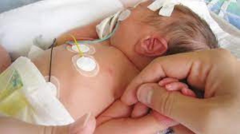 Birth defects in newborns are being discovered through DIC! | ‘डीआयसी’मार्फत शोधले जाताहेत नवजात शिशूंमधील जन्मत:च दोष!