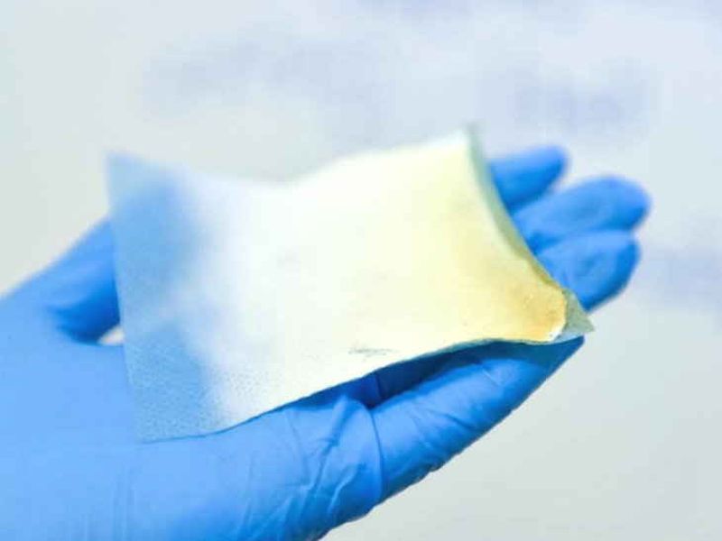 New biodegradable Nanofibre bandage enables faster healing says scientist | पुन्हा पुन्हा ड्रेसिंगच्या कटकटीपासून सुटका करणारं बॅंडेज!