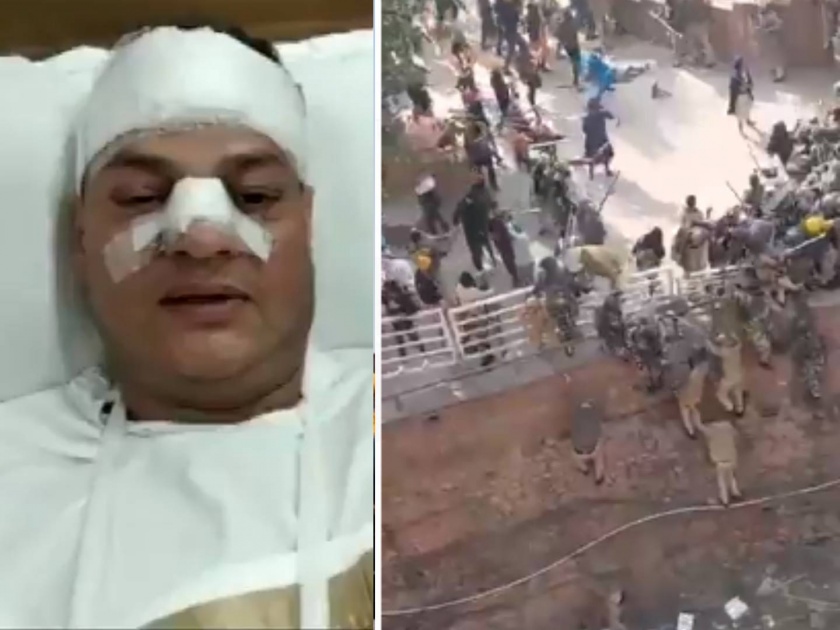 farmer protest video They started stabbing with sticks and swords says injured delhi police office | Video: 'लाठीकाठ्या अन् तलवारीनं त्यांनी सपासप वार केले', गंभीर जखमी झालेल्या पोलिसानं सांगितली आपबिती