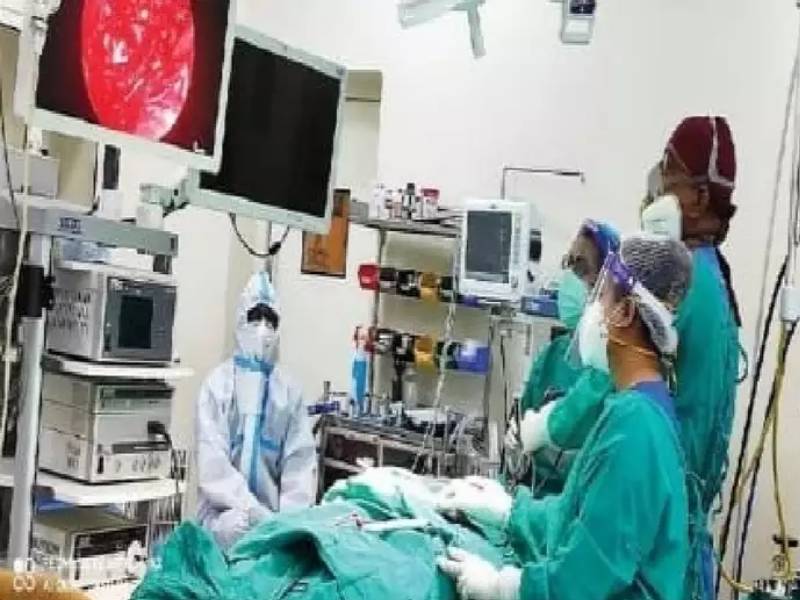 Successful Operation Of 60 Year Old Man Suffering From Black Fungus In Patna Igims Bihar | मेंदूतून काढला तब्बल क्रिकेटच्या चेंडूएवढा 'ब्लॅक फंगस', ३ तास चालली शस्त्रक्रिया!