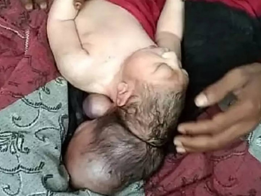 Woman Gave Birth To A Three-Headed Child In Mainpuri | महिलेनं तीन डोकी असलेल्या बाळाला दिला जन्म; पाहण्यासाठी अख्खं गाव जमलं