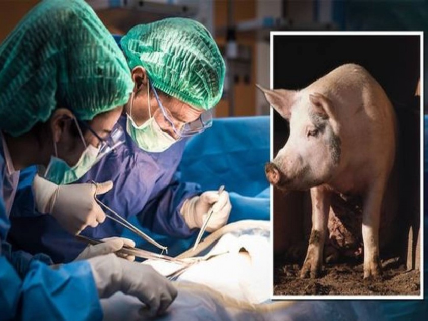 Pig kidney transplant to human Surgeons pass pig kidney transplant test to brain dead human | डुकराच्या किडनीने ब्रेन डेड व्यक्तीचा पुनर्जन्म!