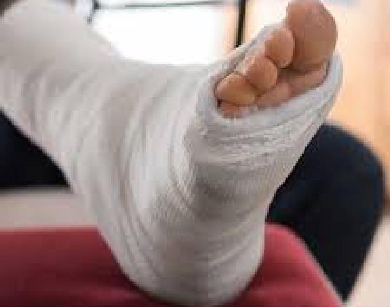 The leg to be broken by the father-in-law | मुलीला मारहाण; सासऱ्याने तोडला जावयाचा पाय