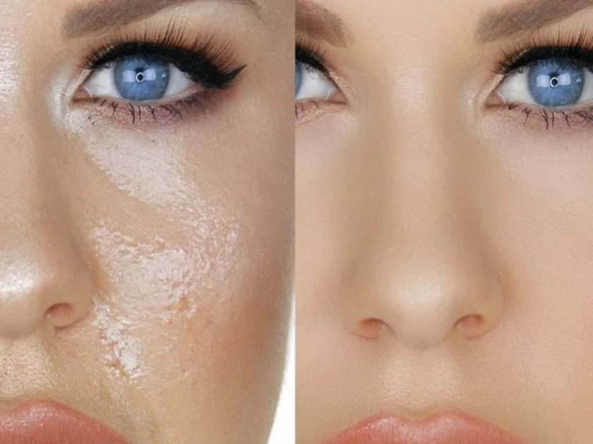 Badam face pack for oily skin best face wash and face pack for oily skin | तेलकट त्वचेसाठी अत्यंत फायदेशीर ठरतो 'हा' फेस पॅक; असा करा तयार