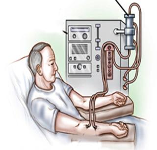 Dialysis section of Shegawa first in the state | शेगावातील डायलिसीस विभाग राज्यात प्रथम