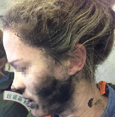 Headphone blast on the plane, the face of the woman's face | विमानात हेडफोनचा स्फोट, महिलेचा भाजला चेहरा