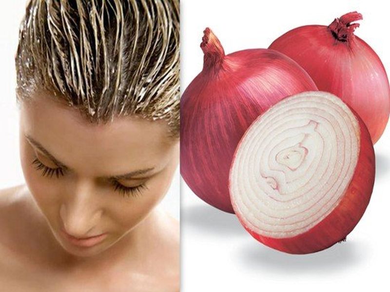Hair care tips : Use onion to get long strong and beautiful hair | घरबसल्या कांद्याच्या मदतीने मिळवा सुंदर-लांब केस, करा हे 5 उपाय!