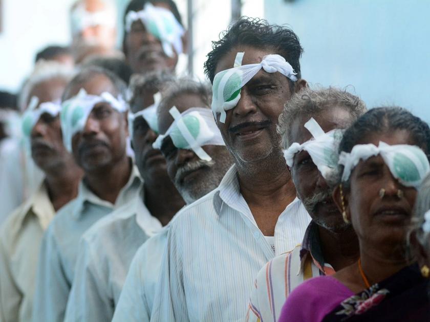 Jharkhand News | In the name of free operation, the old man's eye was removed and a glass eye was installed | धक्कादायक! मोफत ऑपरेशनच्या नावाखाली वृद्धाचा डोळा काढला अन् काचेची गोटी बसवली