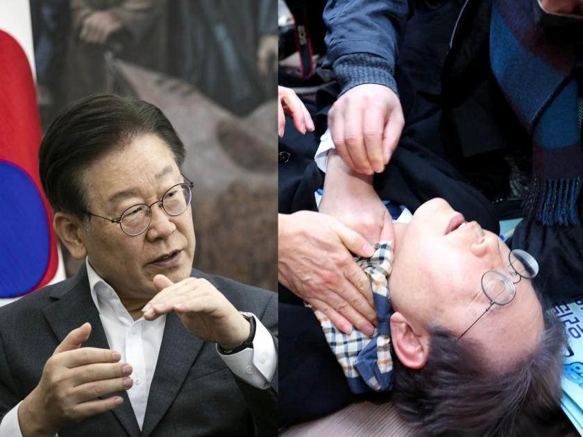 Knife attack on South Korean opposition leader Lee Jae-myung; A blow to the neck | Video: दक्षिण कोरियाचे विरोधीपक्षनेते ली जे-म्युंग यांच्यावर चाकुहल्ला; गळ्यावर वार