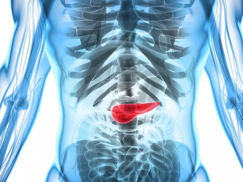 New treatment triggers self-destruction of pancreatic cancer cells | खूशखबर! स्वादुपिंडाच्या कॅन्सरवर सापडला ठोस उपाय, मूळातून नष्ट होणार कॅन्सर...