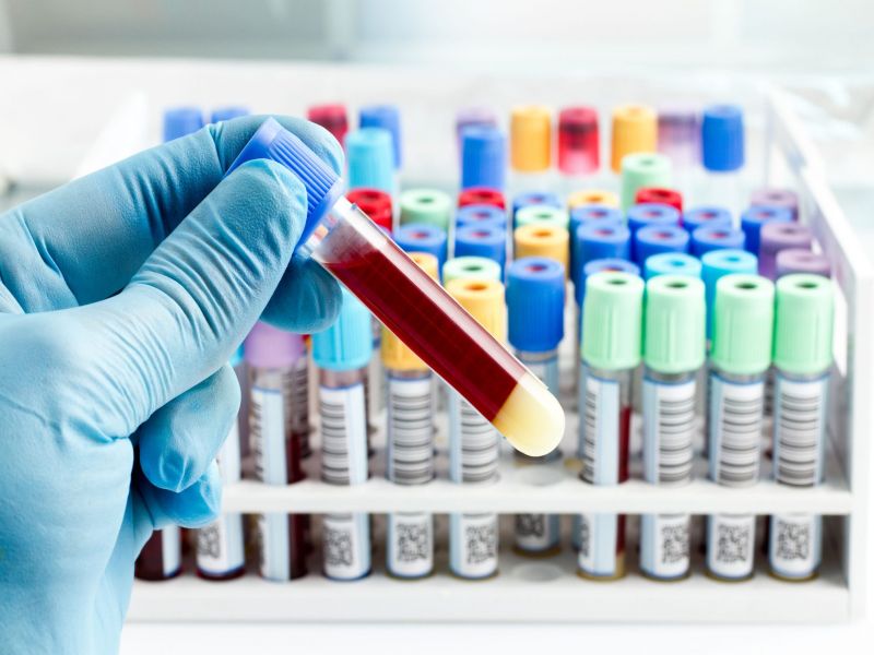 Violation of rules governing the pathology lab in Panvel | पनवेलमध्ये पॅथॉलॉजी लॅबमधून होतेय नियमांचे उल्लंघन