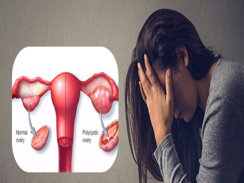 increase in uterine related problems due to fats | लठ्ठपणा ठरतोय '' पीसीओडी'' ला कारणीभूत