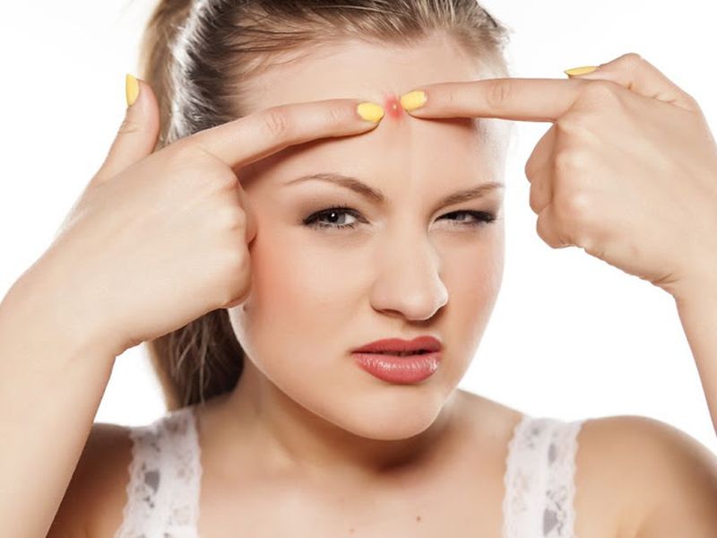 Severe infection may arise if you break out pimple | चेहऱ्यावरील पिंपल्स फोडताय?; असं करणं ठरू शकतं घातक