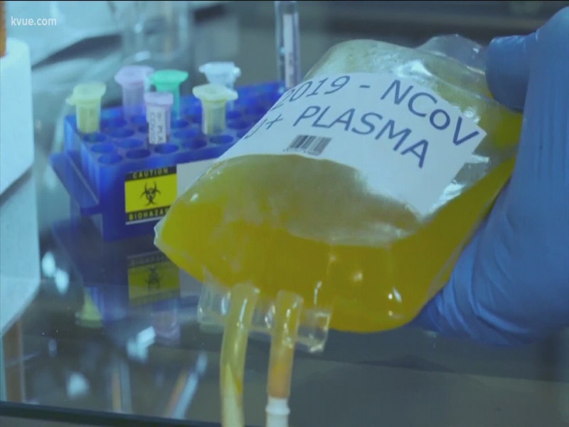 Corona Virus : Private hospitals to get 'Plasma' bags in Pimpri on 'No Profit No Loss' principle! | Corona Virus : पिंपरीत 'ना नफा ना तोटा' तत्त्वावर खासगी रुग्णालयांना मिळणार 'प्लाझ्मा' बॅग्ज!