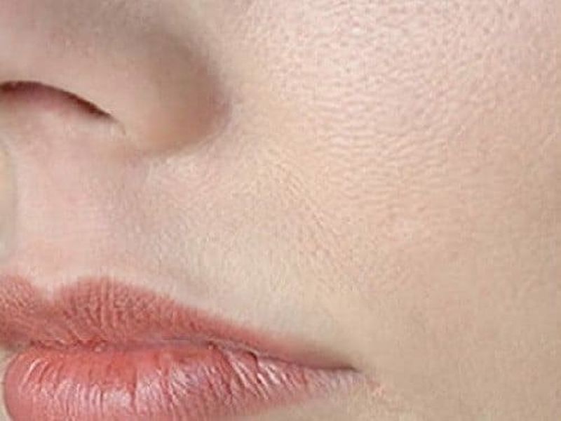 Why facial pores become big and how to remove them | चेहऱ्याची रोमछिद्रे का होतात मोठे आणि कसे दूर कराल याचे डाग?