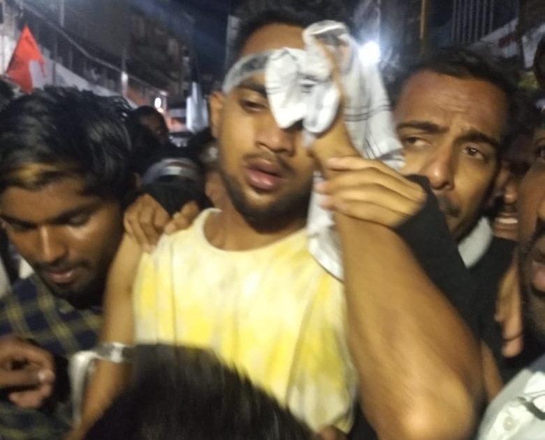 Ganesh Visarjan 2018: Three activists of Praktis Club injured in police raid, injuries stopped | Ganesh Visarjan 2018 : पोलिसांच्या लाठीमारमध्ये ‘प्रॅक्टीस क्लब’ चे तीन कार्यकर्ते जखमी, मिरवणूक थांबली
