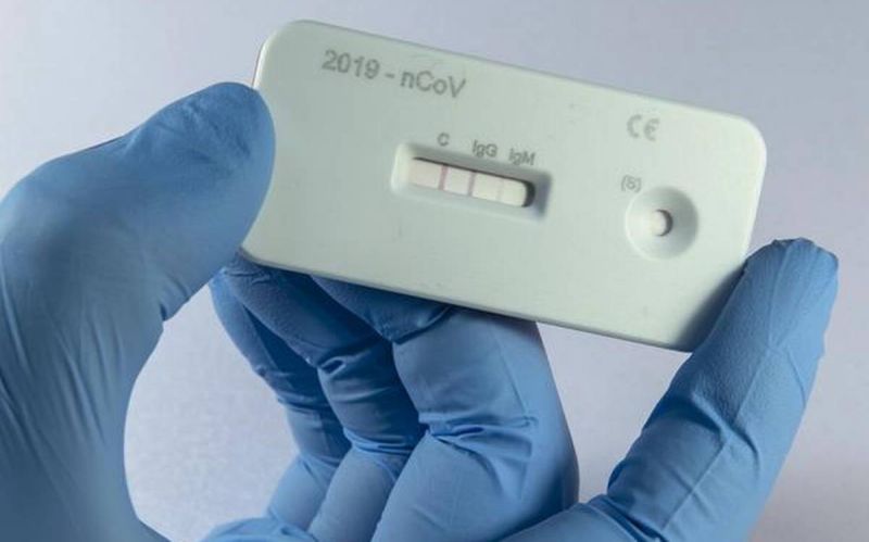 CoronaVirus: Rapid antigen test of 163 people in Washim district; 11 Positive | CoronaVirus : वाशिम जिल्ह्यात १६३ जणांची रॅपिड अँटीजन टेस्ट; ११ पॉझिटिव्ह